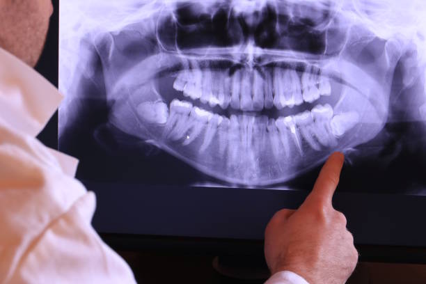 Best Emergency Treatment for Toothache in Nolensville, TN